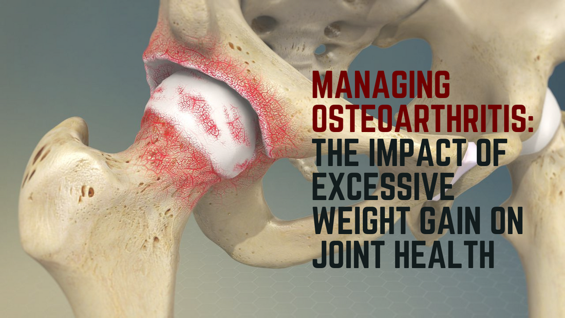 Managing Osteoarthritis: The Impact of Excessive Weight Gain on Joint Health